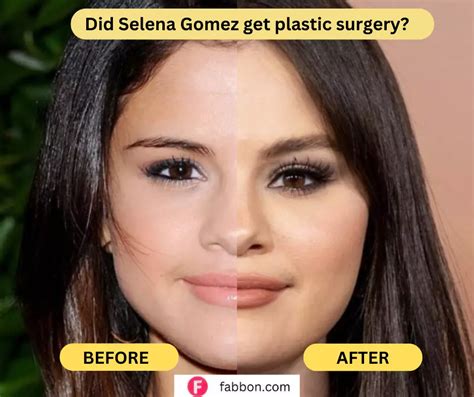 when did selena gomez boobs get so big|Selena Gomez Opens Up About Cosmetic Surgery & Reacts to。